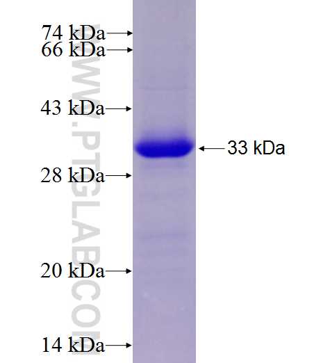 WDR88 fusion protein Ag27418 SDS-PAGE