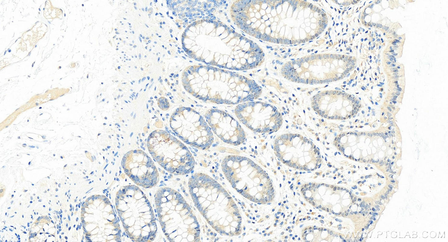 IHC staining of human colon using 25540-1-AP