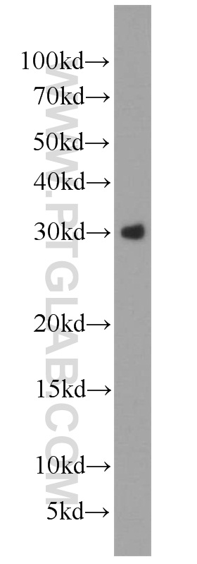 WB analysis of HEK-293 using 13204-1-AP