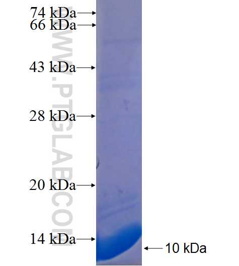 WFDC11 fusion protein Ag22425 SDS-PAGE