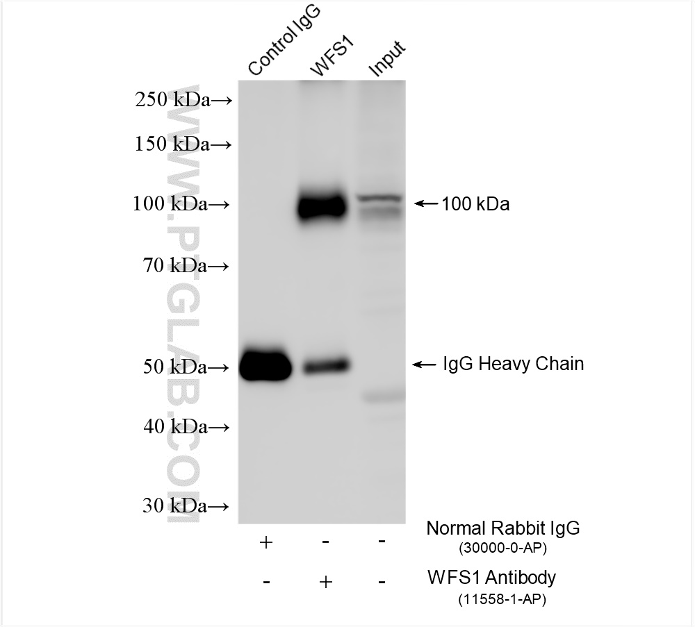 IP experiment of SH-SY5Y using 11558-1-AP