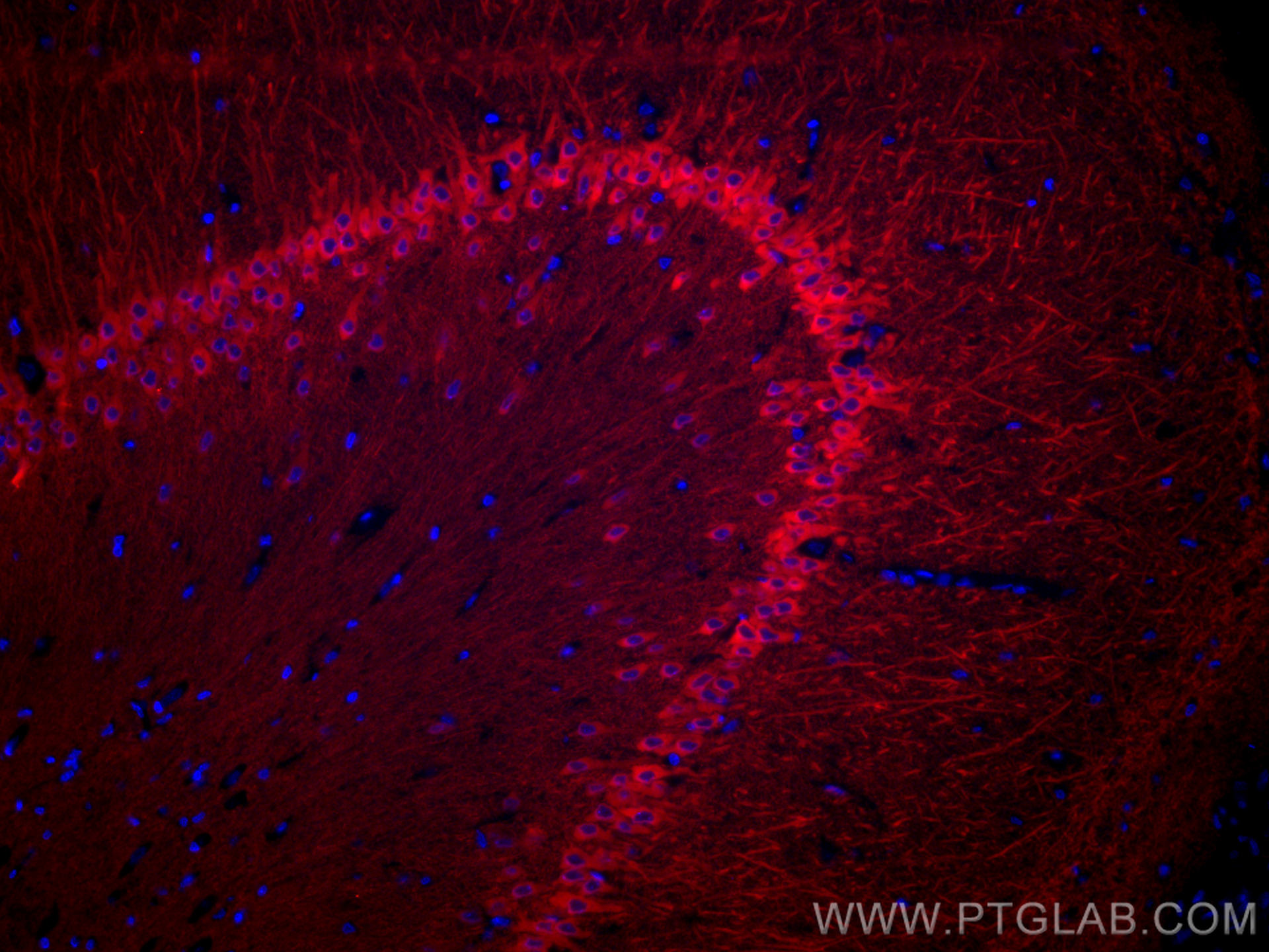 IF Staining of rat brain using CL594-26995