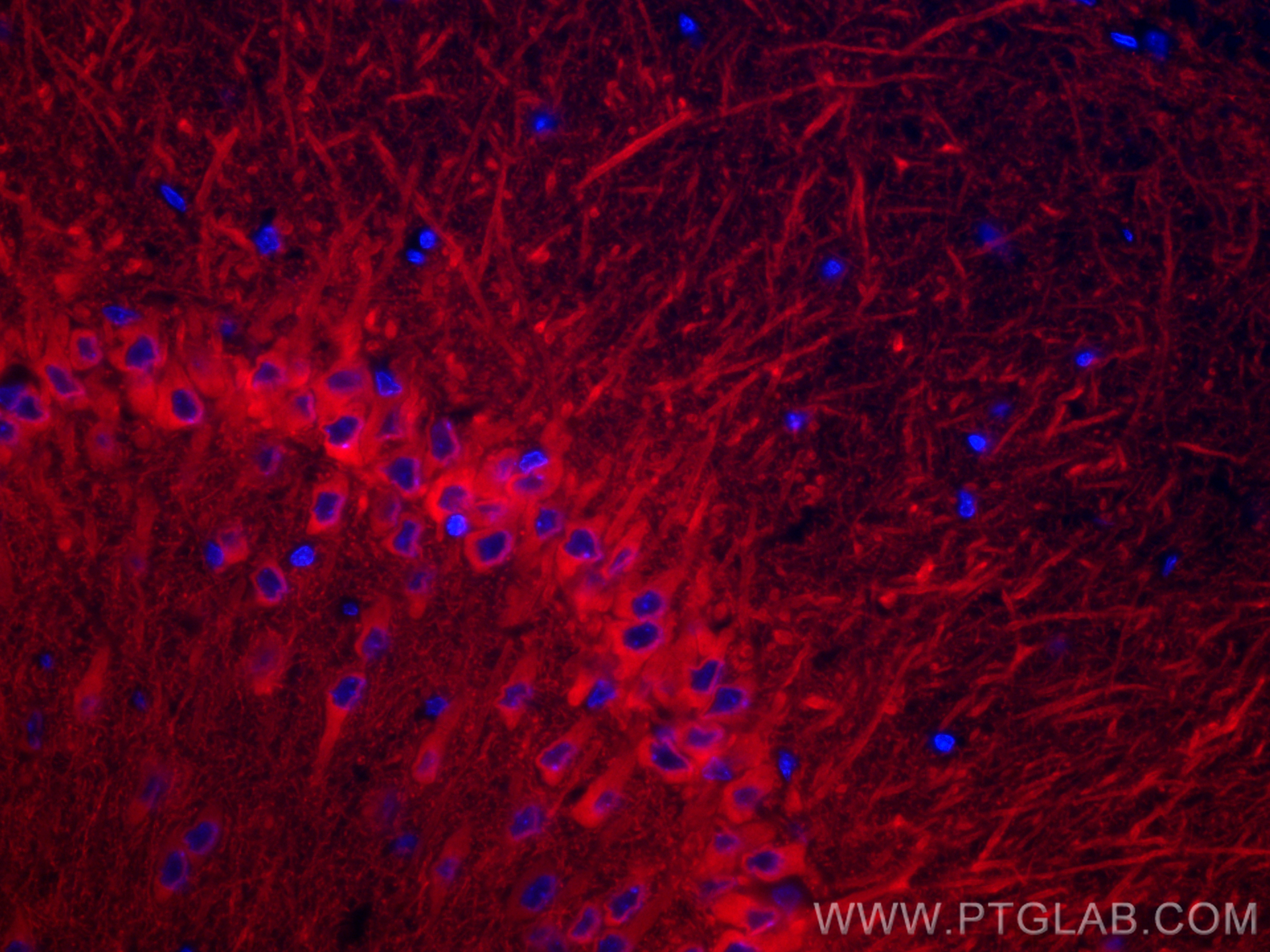 IF Staining of rat brain using CL594-26995