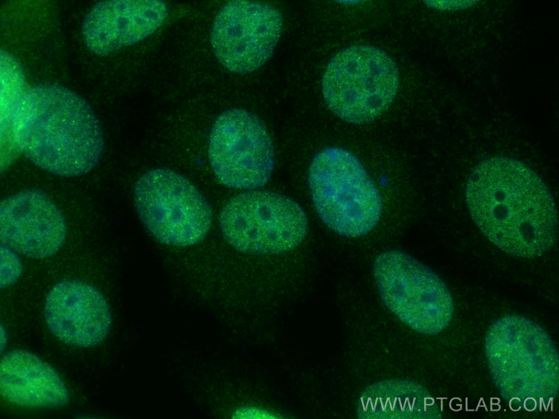 IF Staining of MCF-7 using 11345-1-AP