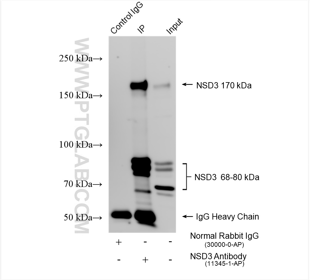 IP experiment of HeLa using 11345-1-AP