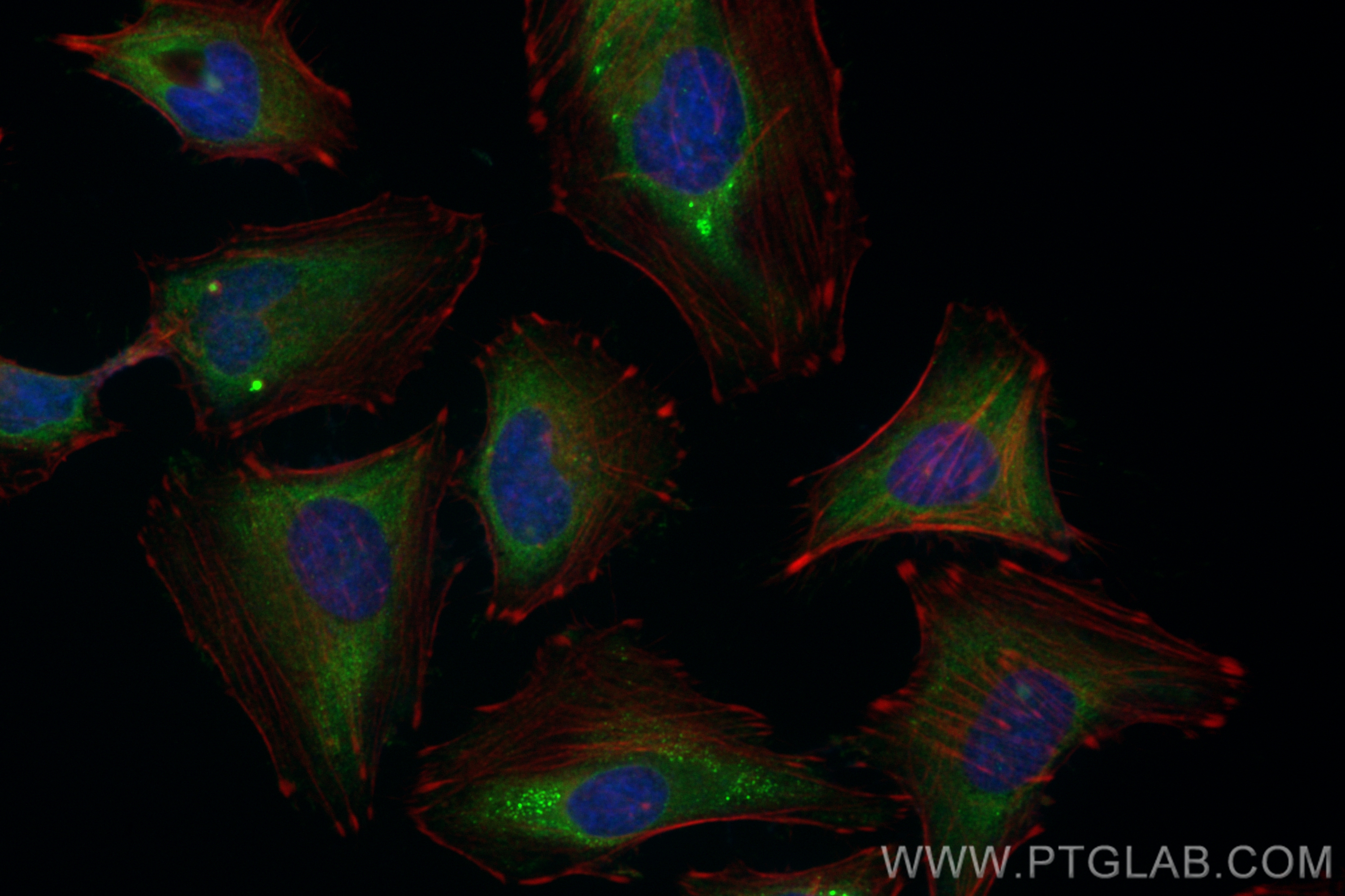 IF Staining of HeLa using CL488-28820