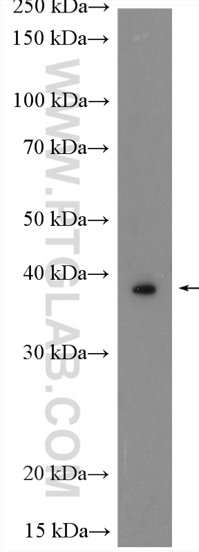 WB analysis of Caco-2 using 21259-1-AP