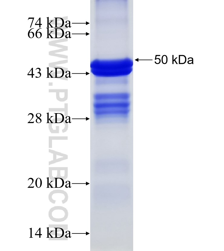 WISP3 fusion protein Ag15238 SDS-PAGE