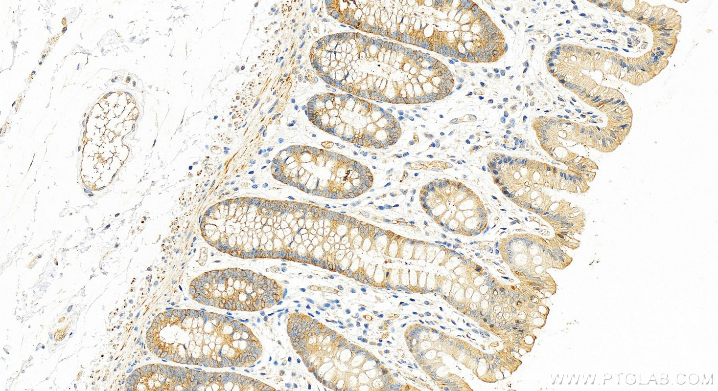 IHC staining of human colon using 22326-1-AP