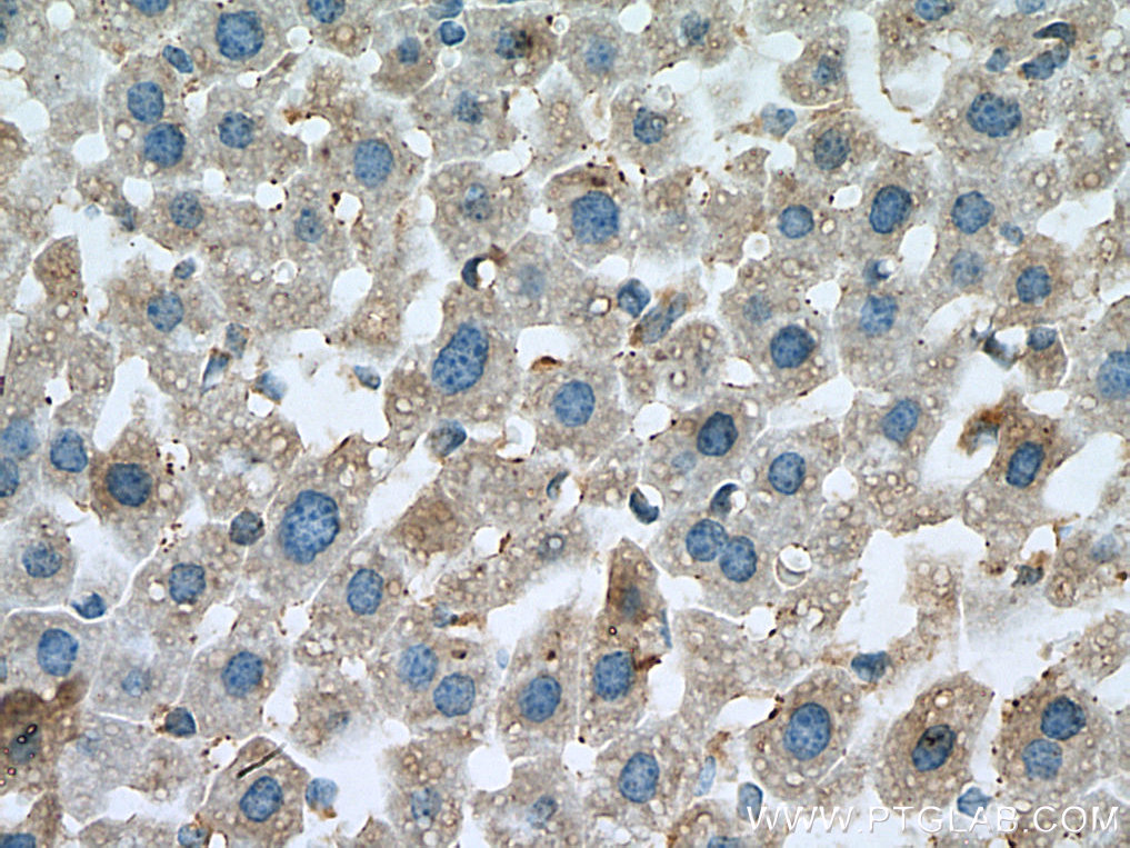 IHC staining of mouse liver using 67210-1-Ig (same clone as 67210-1-PBS)