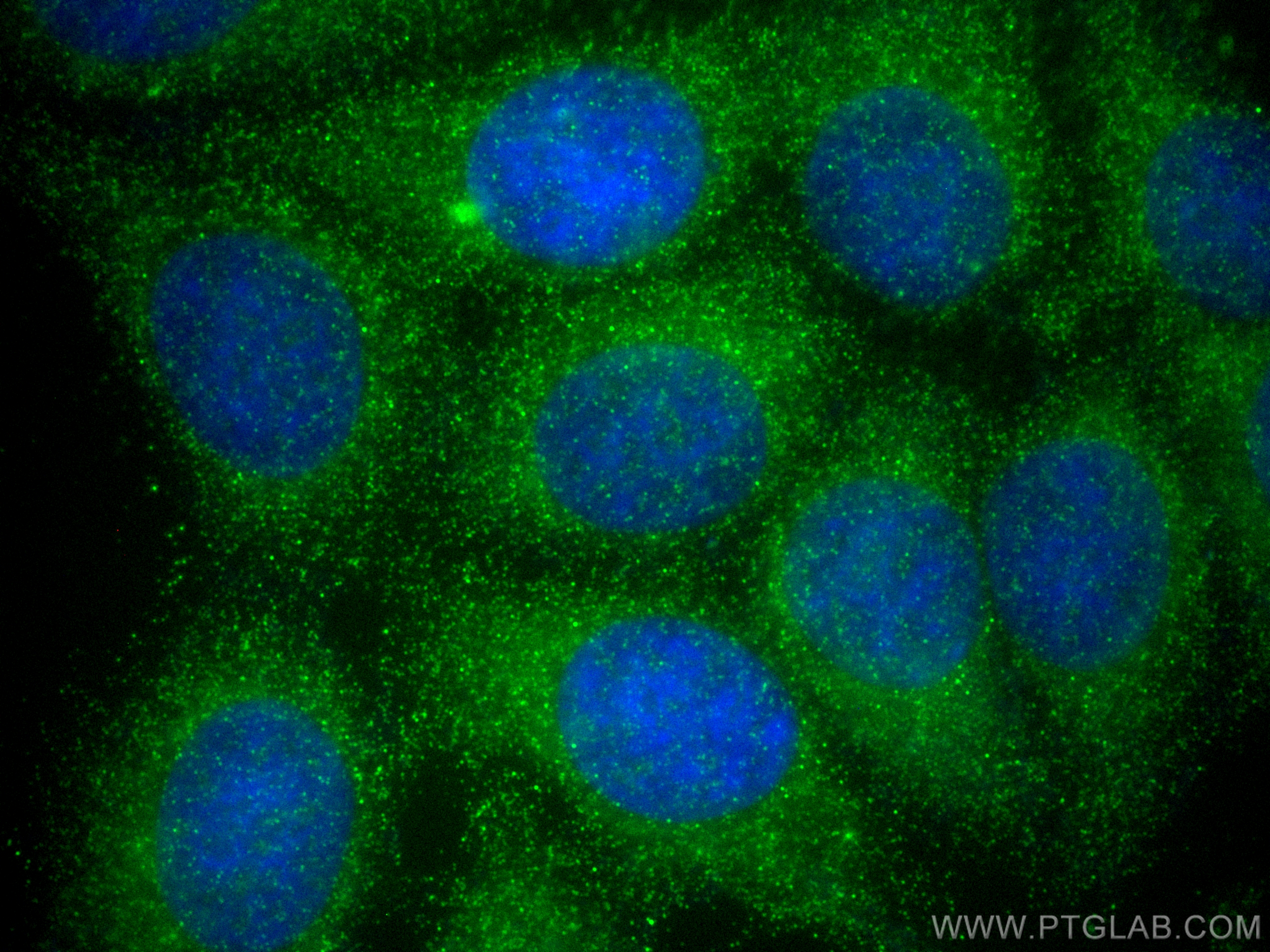 IF Staining of MCF-7 using 14371-1-AP