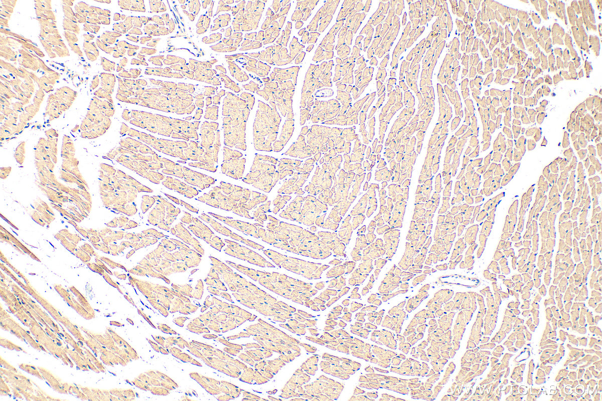 IHC staining of mouse heart using 55184-1-AP