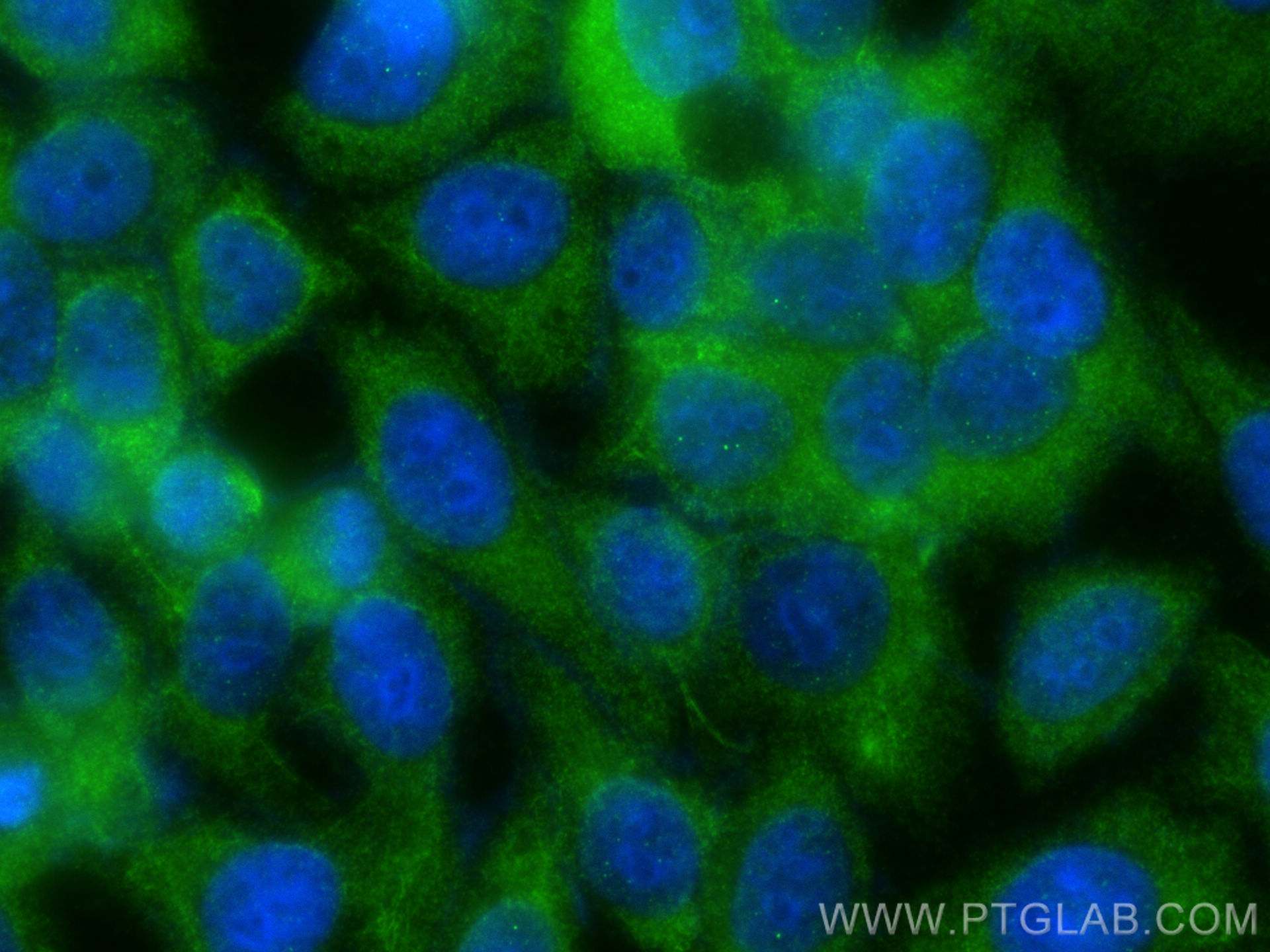 IF Staining of HepG2 using 27177-1-AP