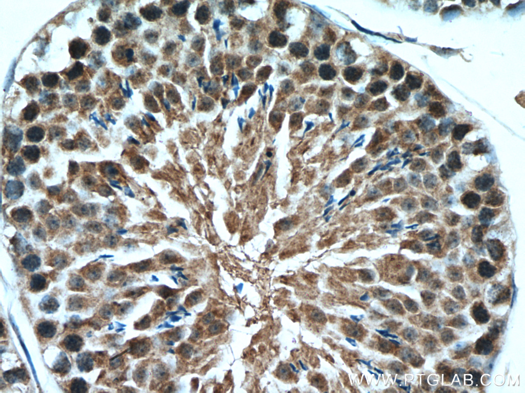 IHC staining of mouse testis using 14761-1-AP