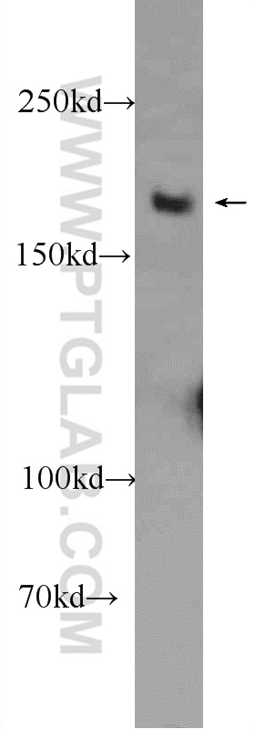 WB analysis of MCF-7 using 25269-1-AP