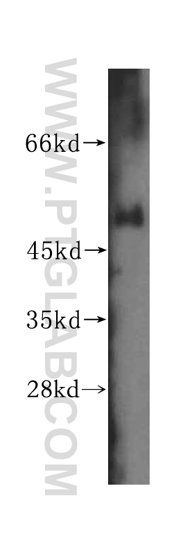 WB analysis of human colon using 16238-1-AP