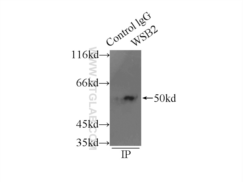 IP experiment of mouse kidney using 12124-2-AP