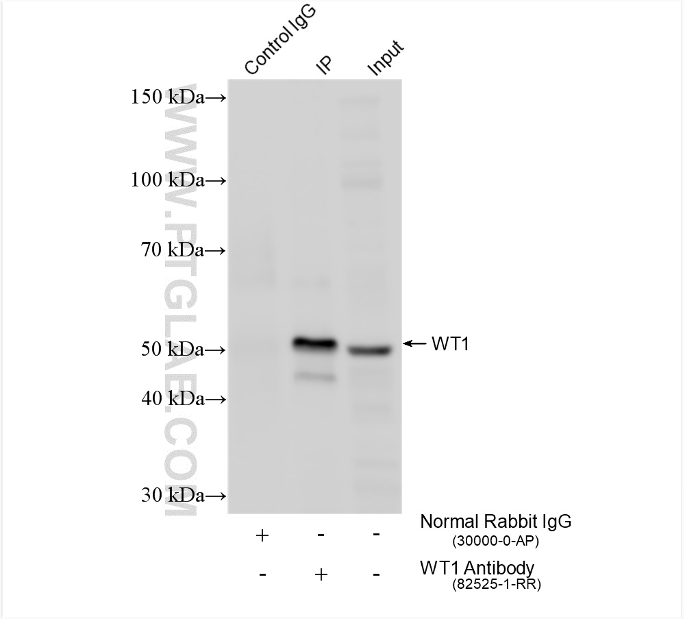 IP experiment of K-562 using 82525-1-RR