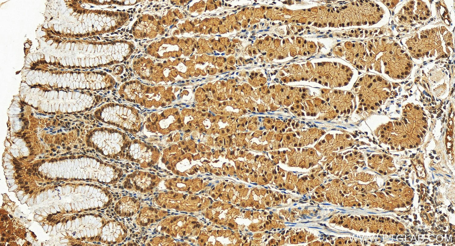 IHC staining of human stomach using 10200-1-AP