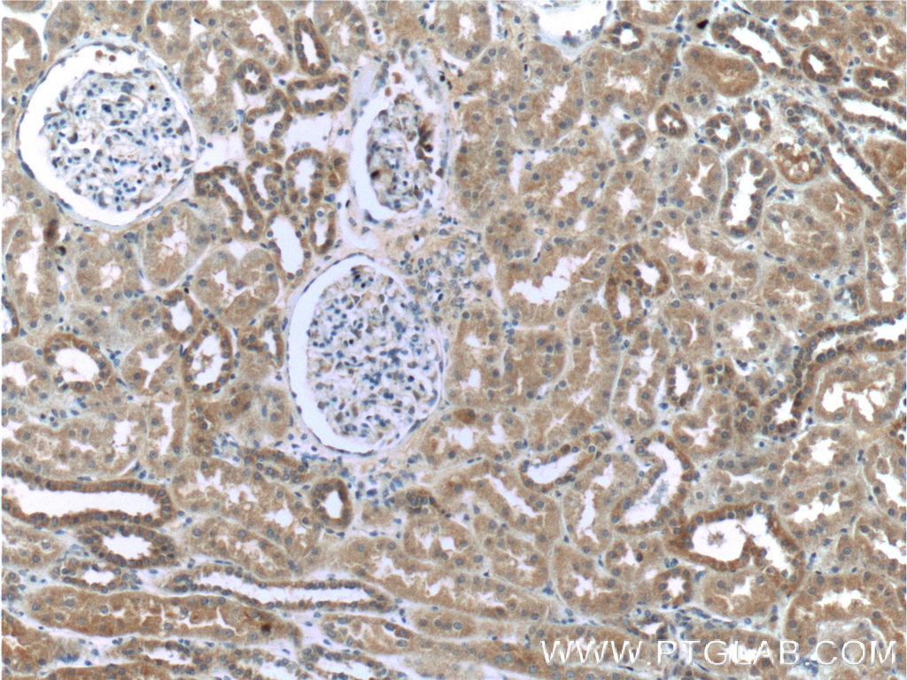 IHC staining of human kidney using 55432-1-AP