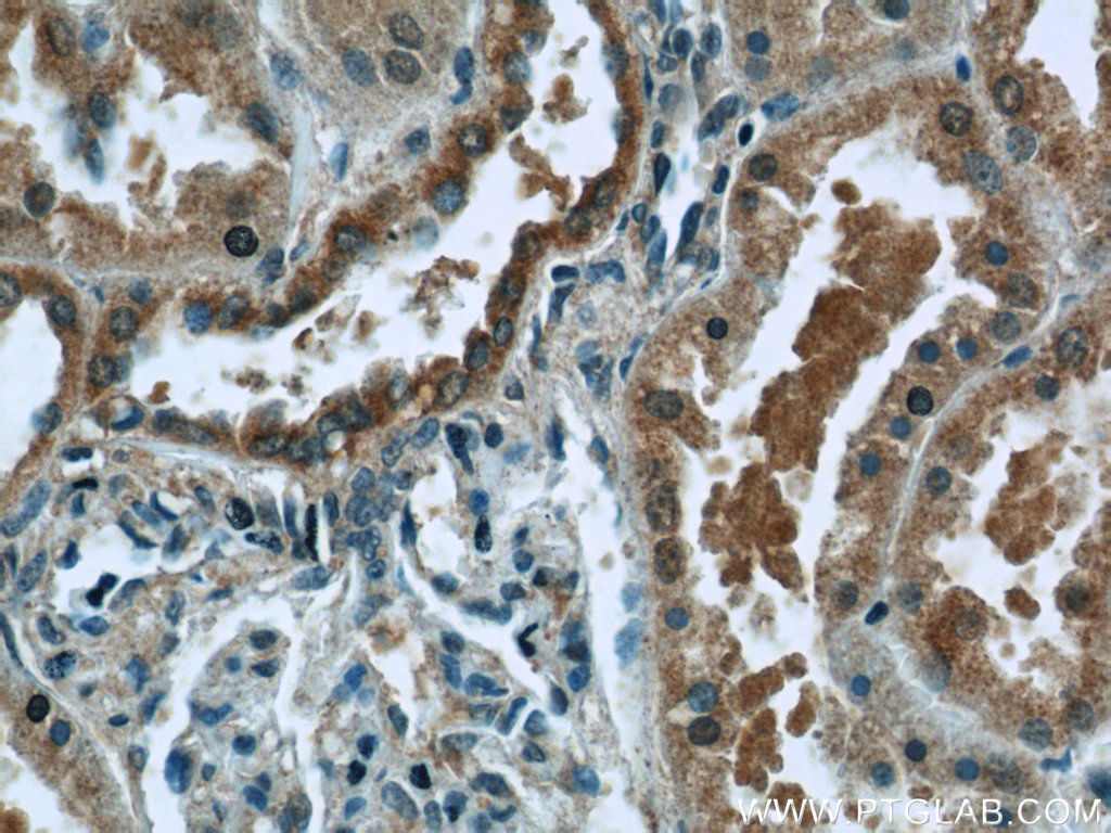 IHC staining of human kidney using 24750-1-AP