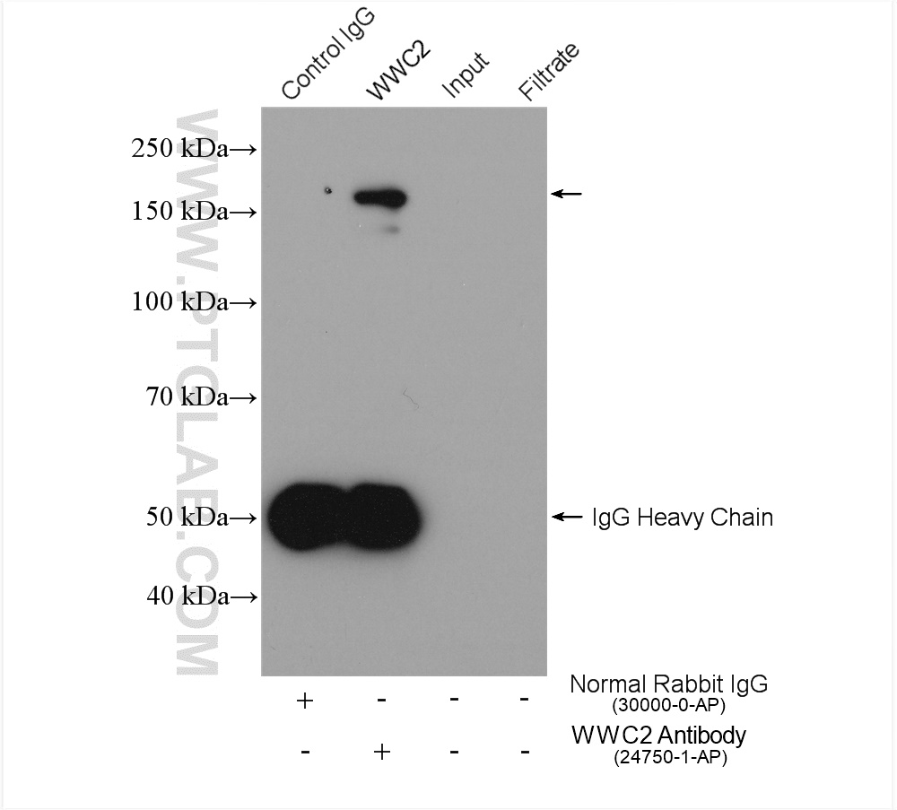 IP experiment of HEK-293 using 24750-1-AP