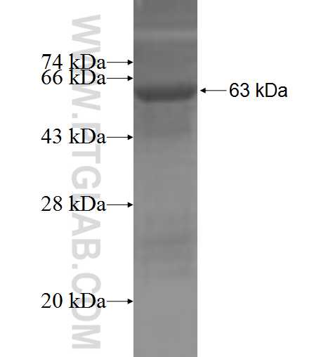 WWP1 fusion protein Ag3582 SDS-PAGE