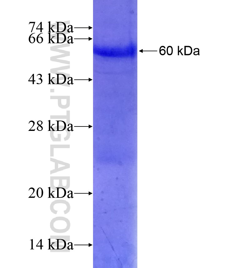 WWP2 fusion protein Ag29179 SDS-PAGE