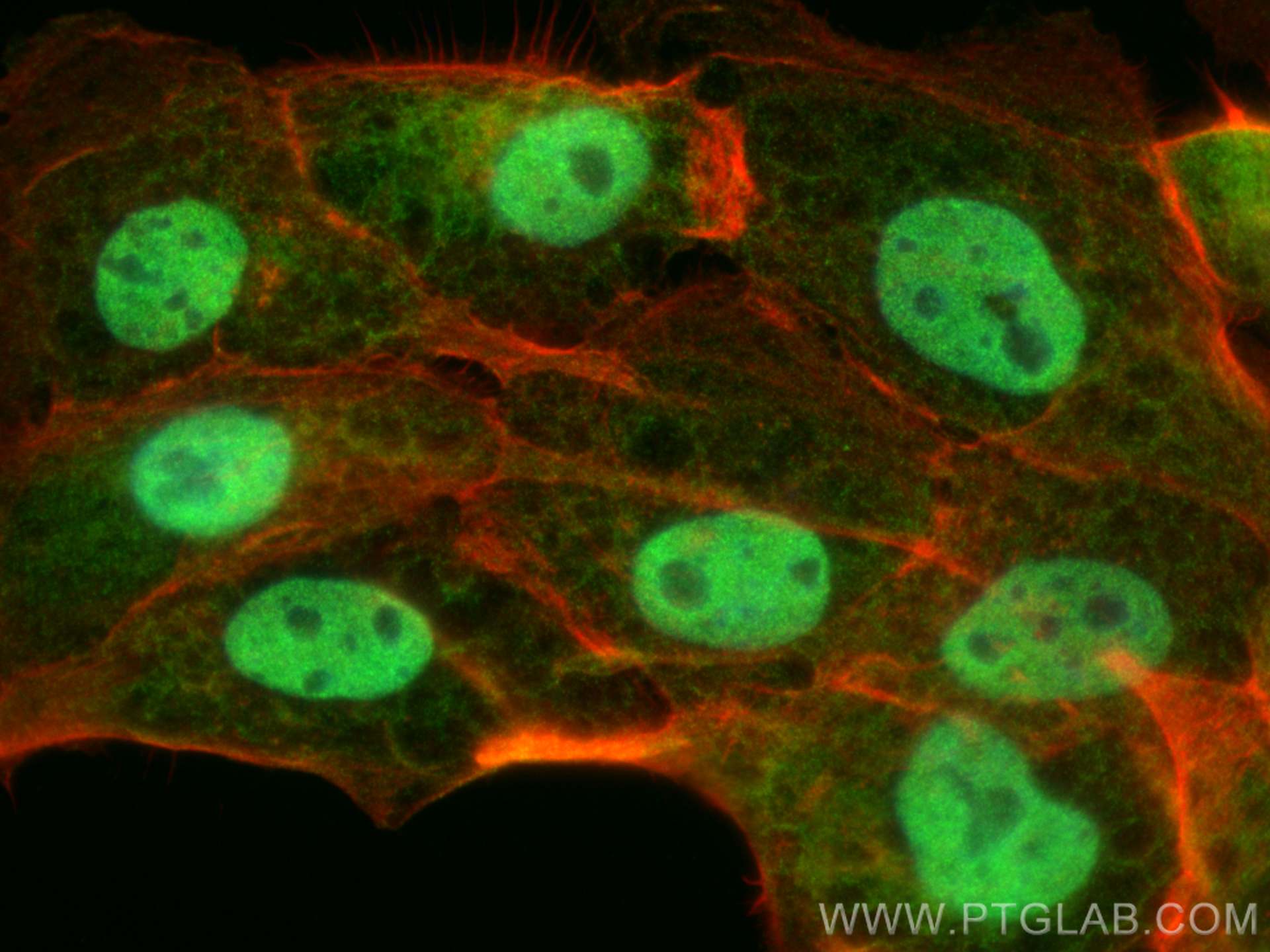 IF Staining of U-251 using 23306-1-AP