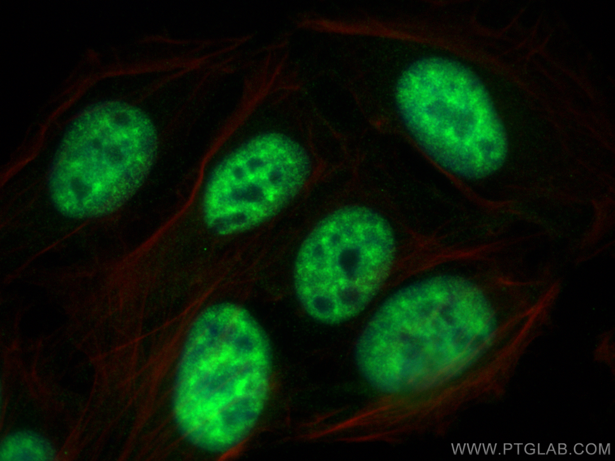 IF Staining of U2OS using 10637-1-AP