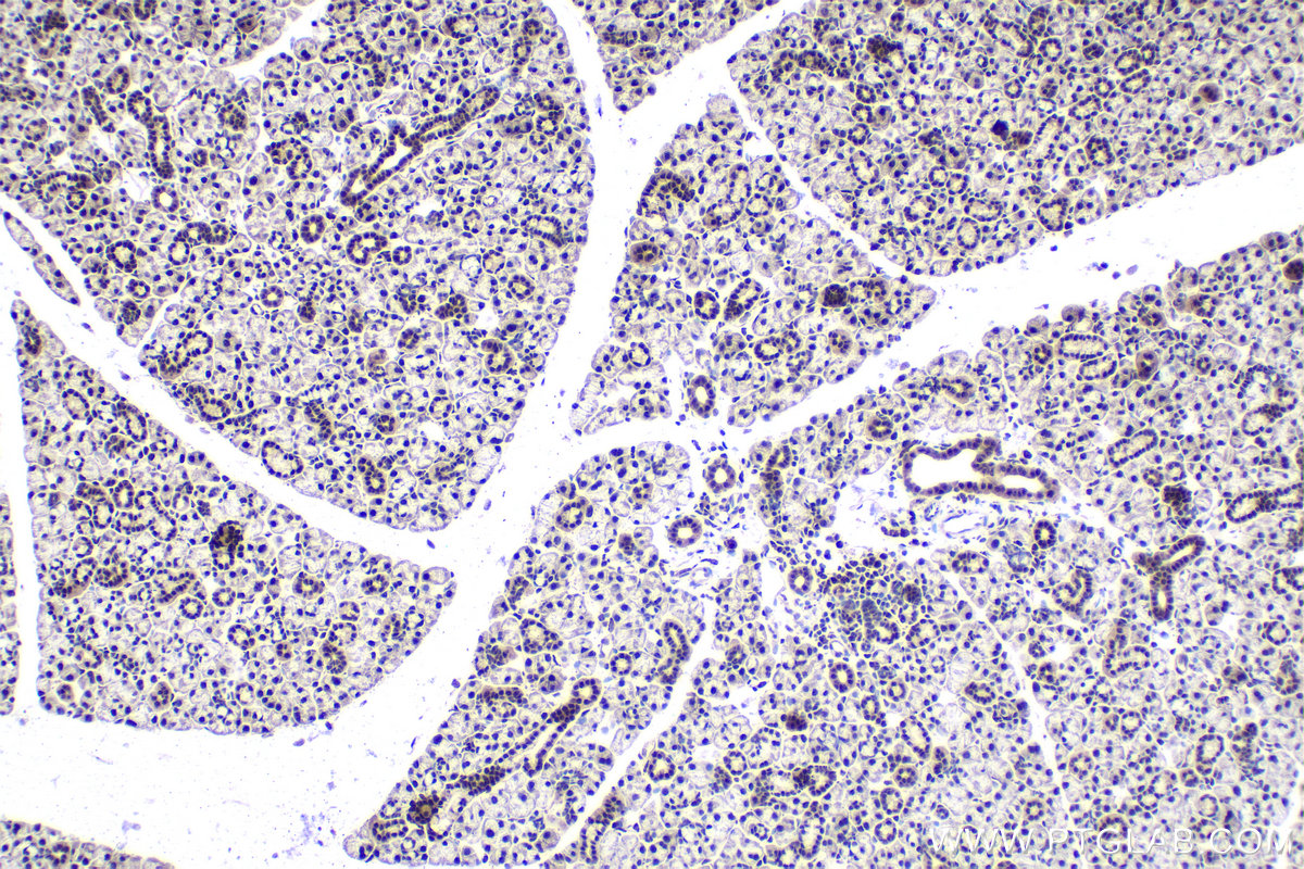 IHC staining of mouse salivary gland using 10637-1-AP