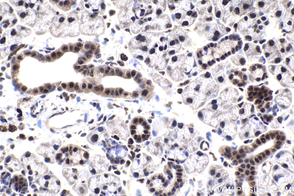 IHC staining of mouse salivary gland using 10637-1-AP