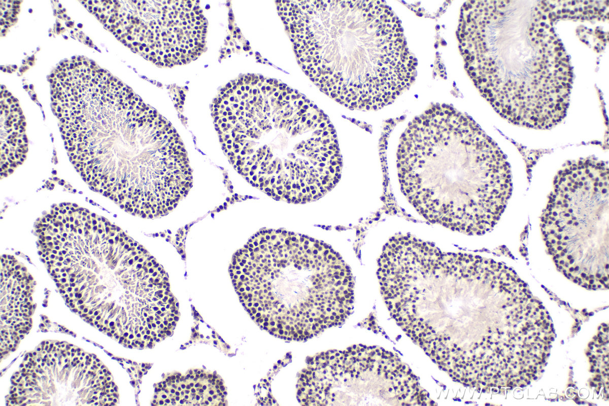 IHC staining of rat testis using 10637-1-AP