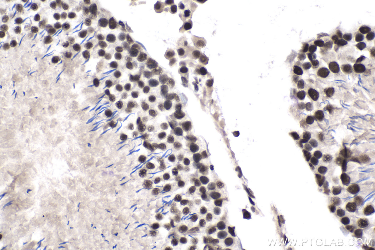 IHC staining of rat testis using 10637-1-AP