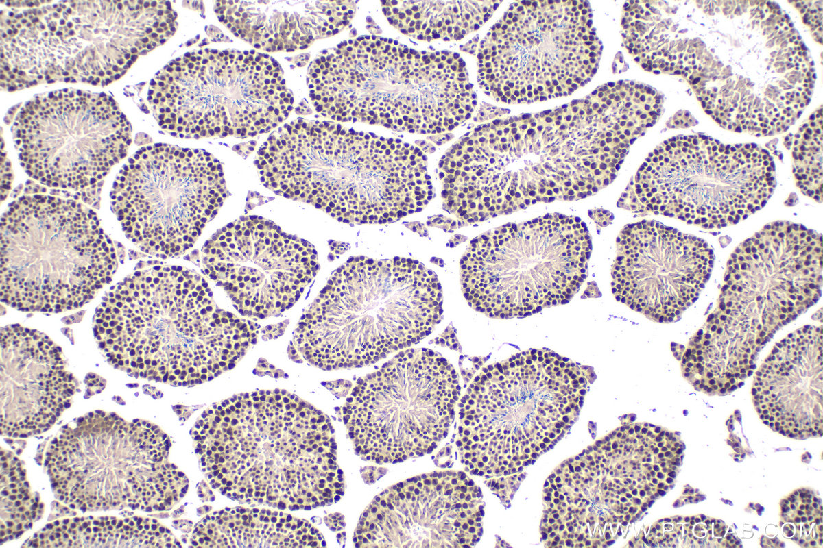 IHC staining of mouse testis using 10637-1-AP