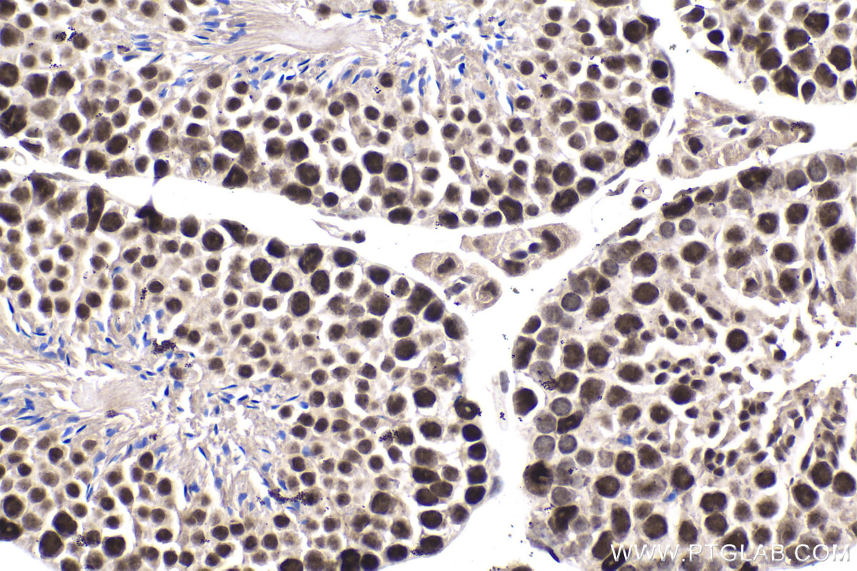 IHC staining of mouse testis using 10637-1-AP