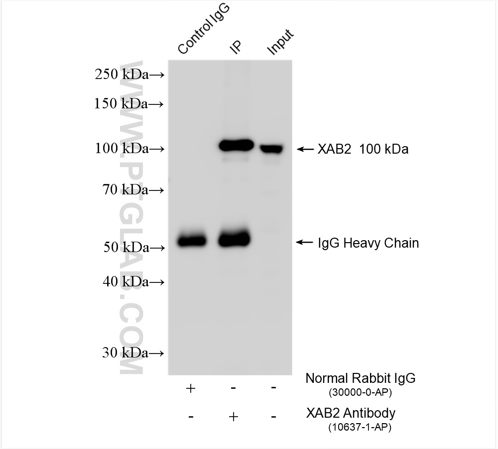 IP experiment of K-562 using 10637-1-AP