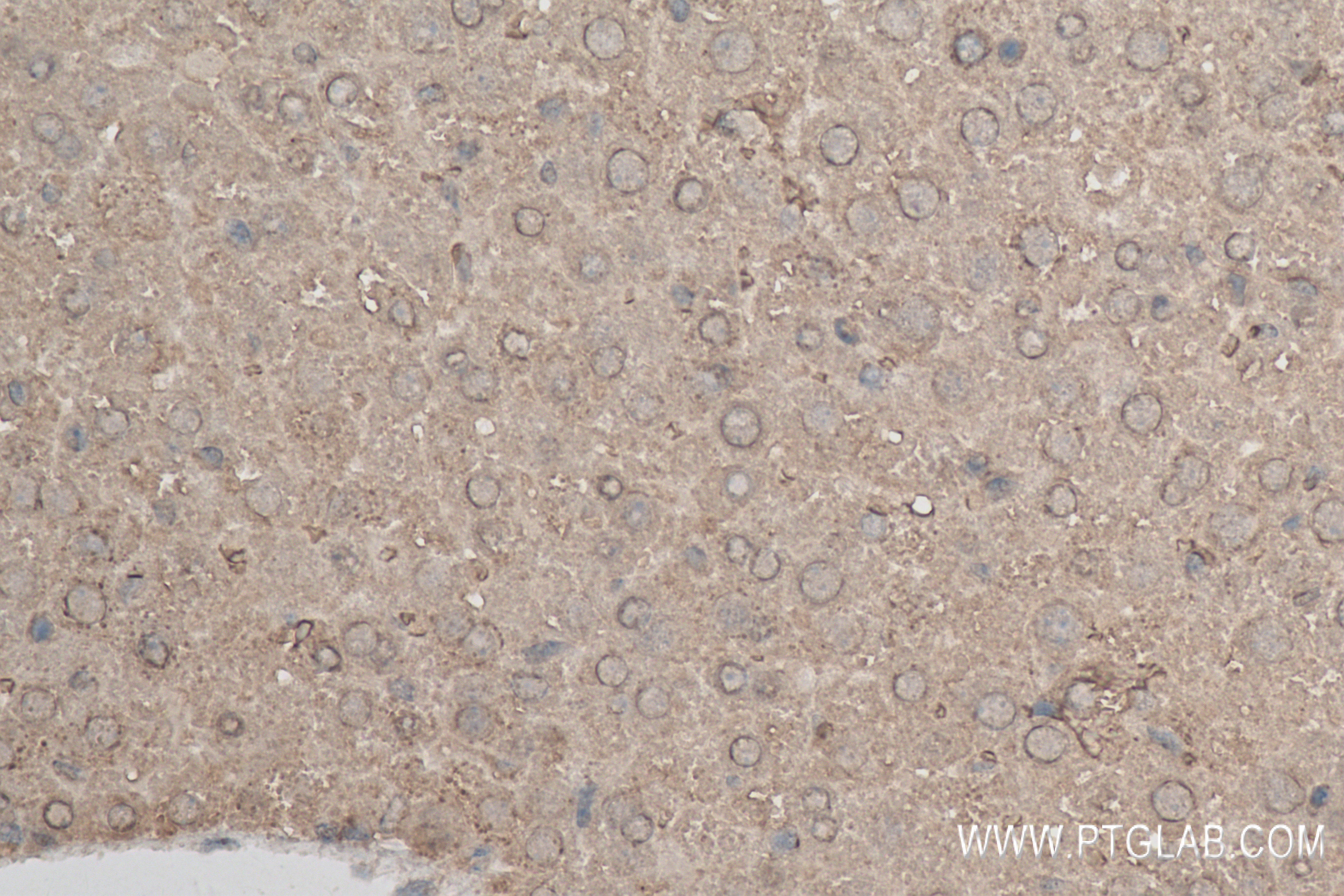 IHC staining of mouse liver using 83959-5-RR