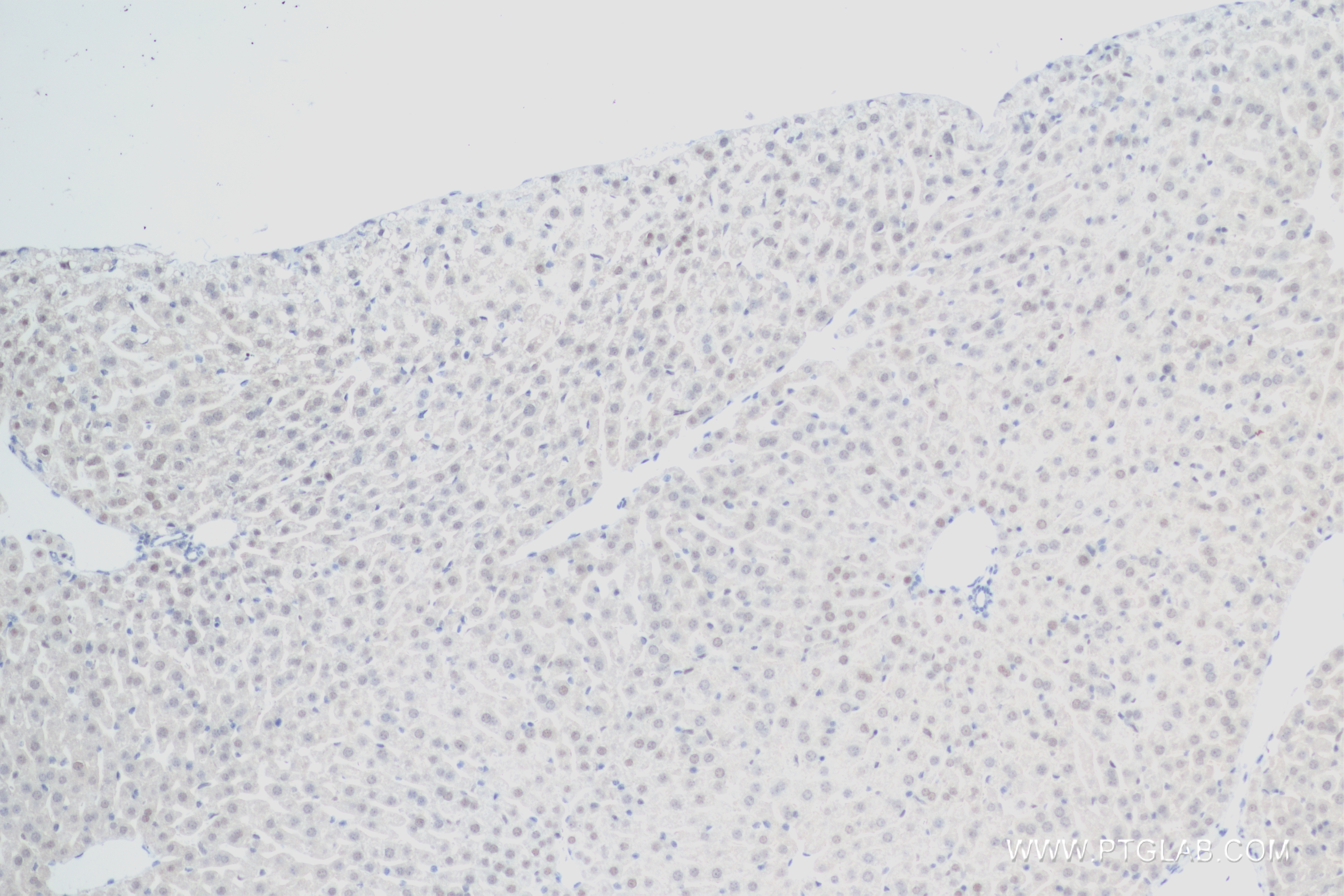 IHC staining of mouse liver using 83959-6-RR