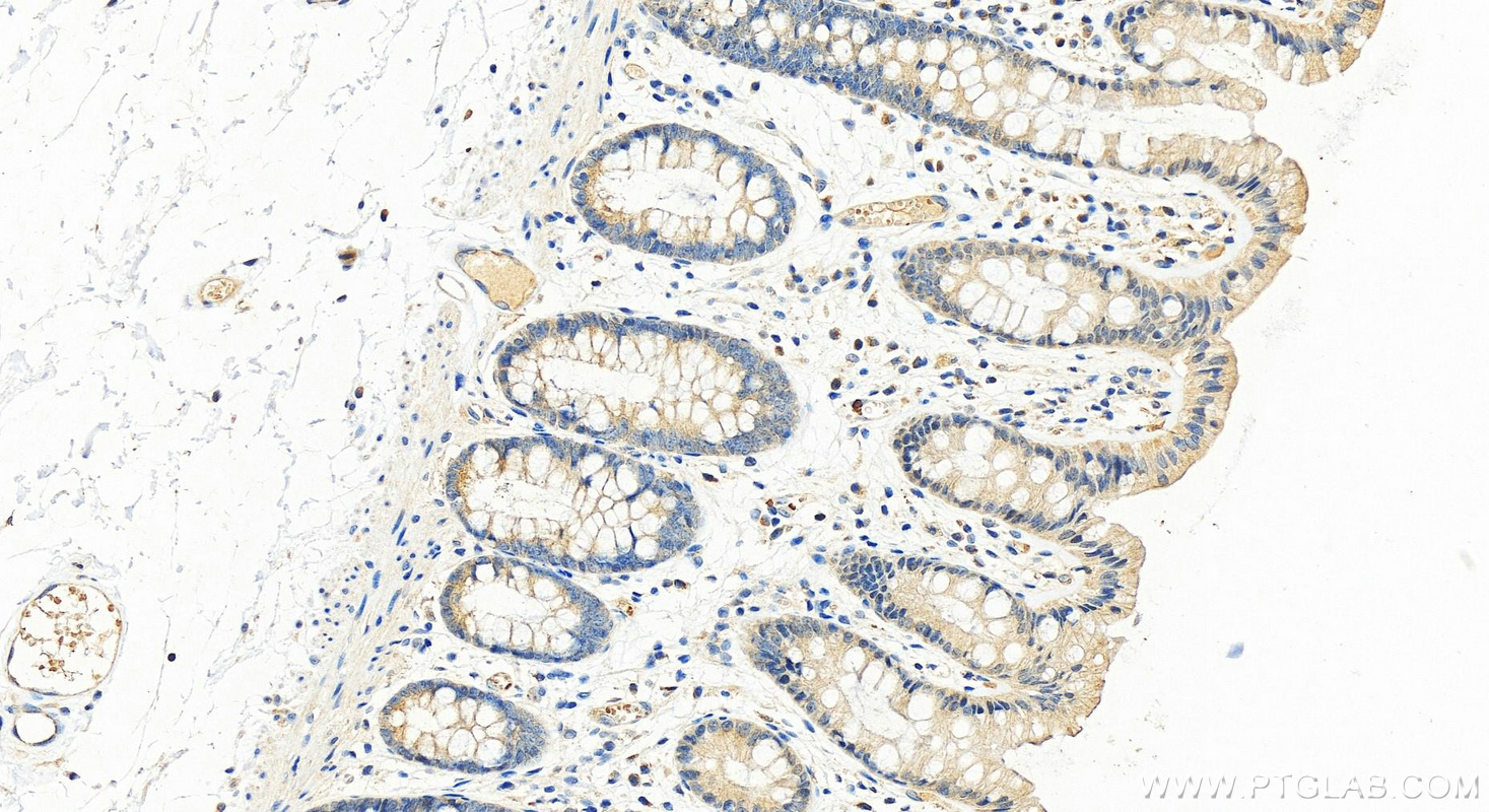 IHC staining of human colon using 23453-1-AP