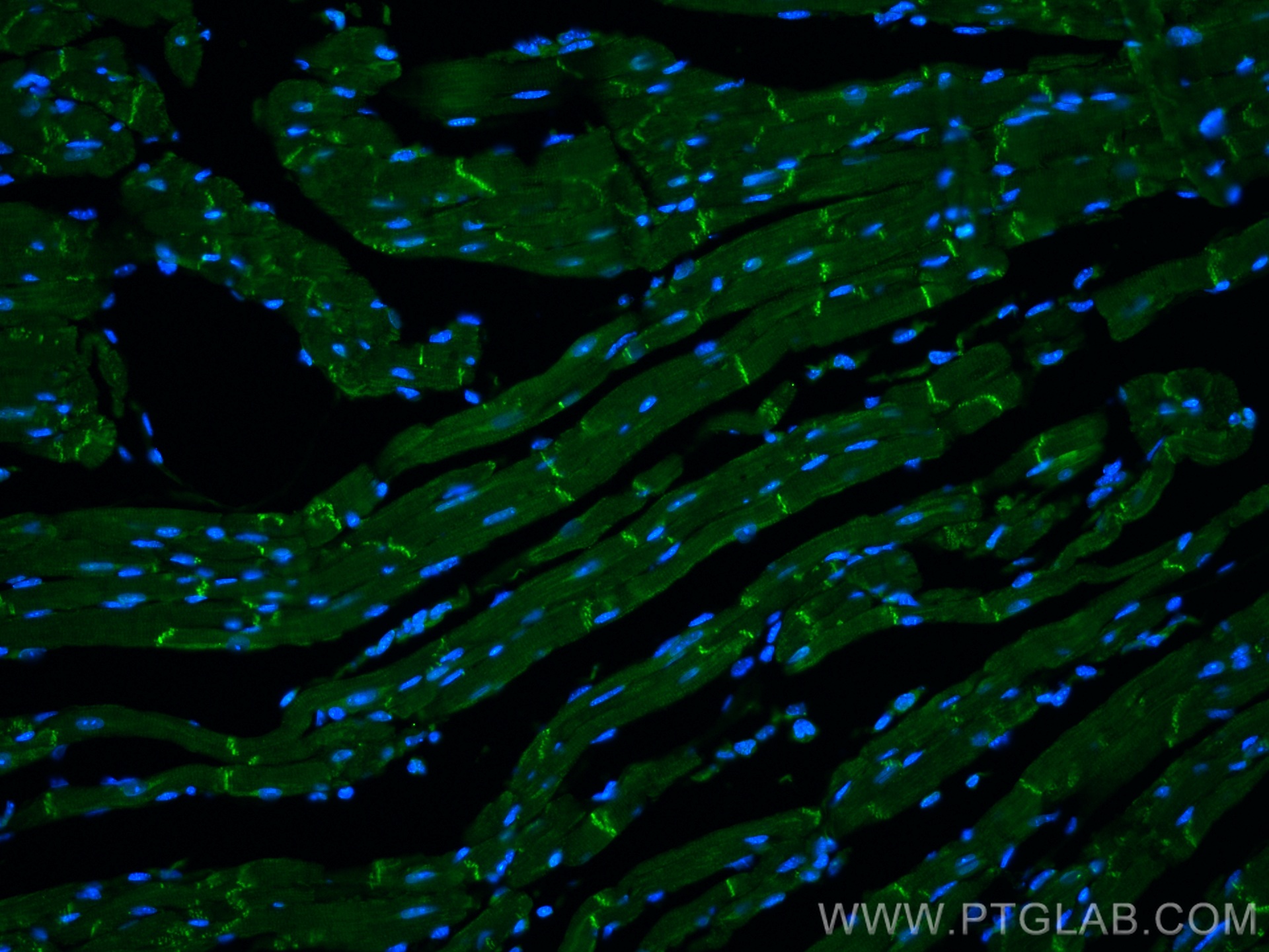 IF Staining of mouse heart using 11896-1-AP