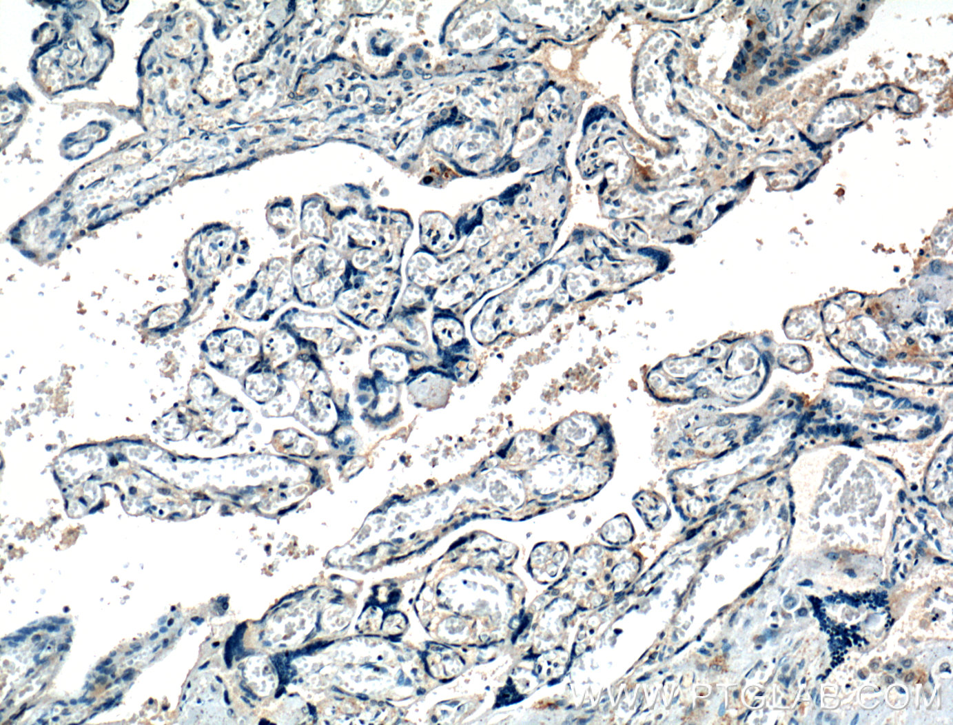 IHC staining of human placenta using 27049-1-AP