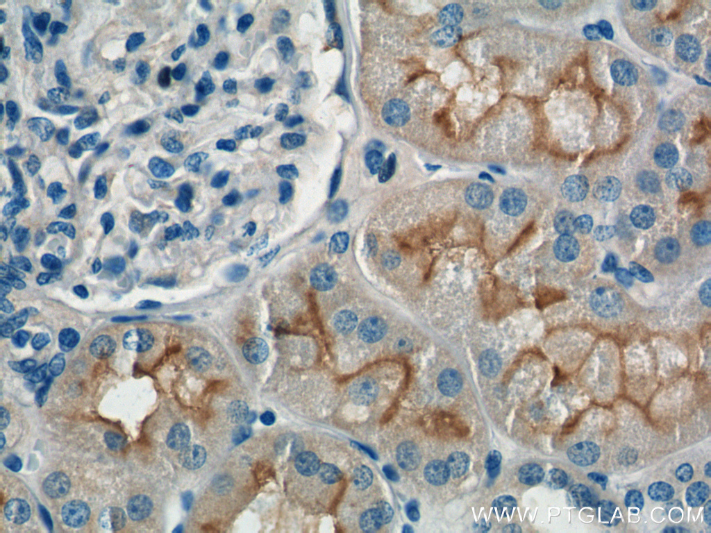 IHC staining of human kidney using 25945-1-AP