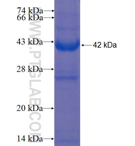 XPNPEP2 fusion protein Ag22952 SDS-PAGE
