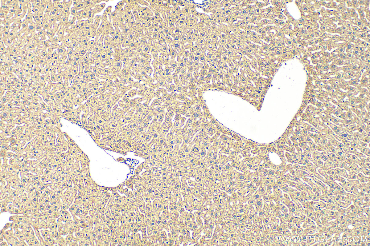 IHC staining of mouse liver using 15655-1-AP