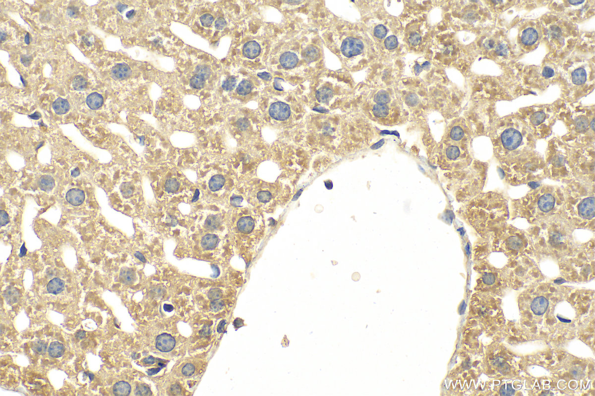 IHC staining of mouse liver using 15655-1-AP