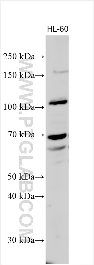 WB analysis using 14174-1-AP