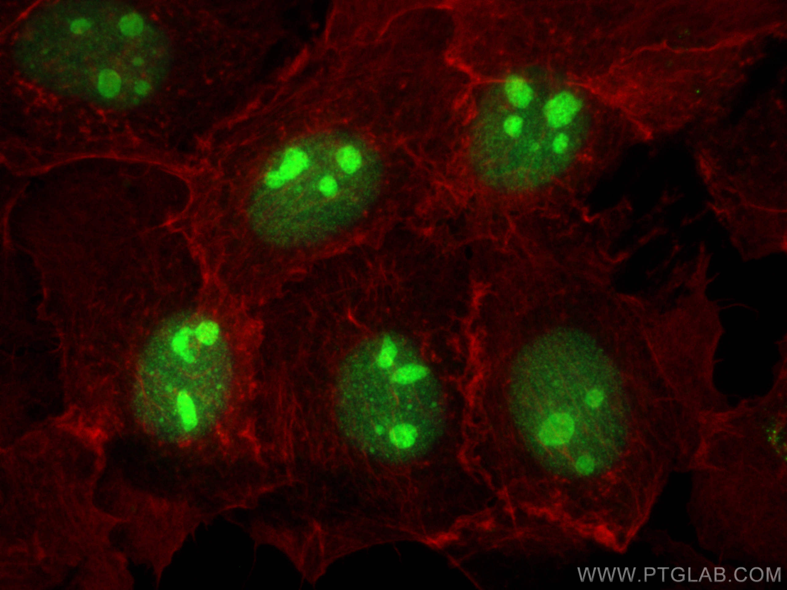 IF Staining of A431 using 21468-1-AP