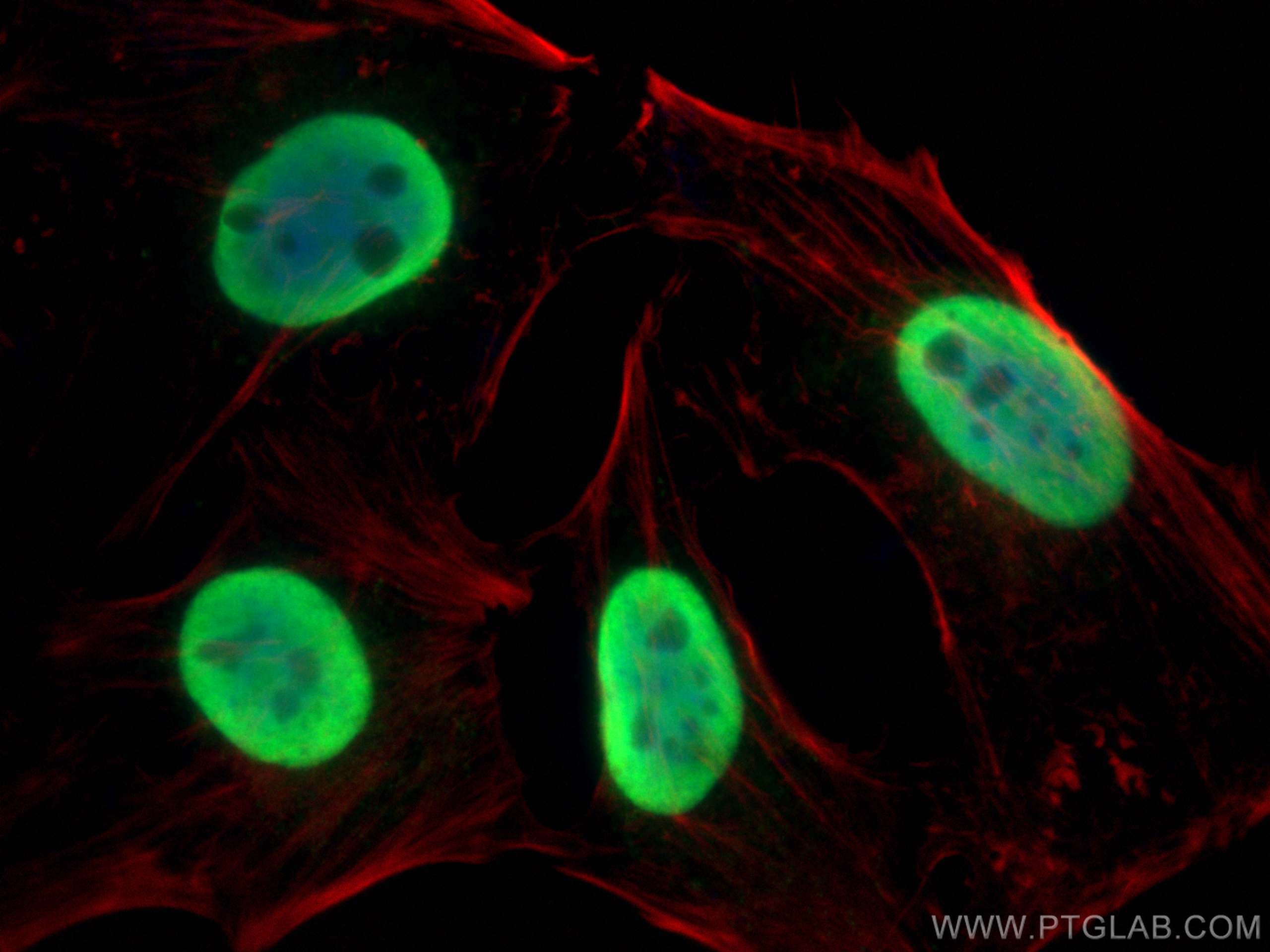 IF Staining of HeLa using 16389-1-AP