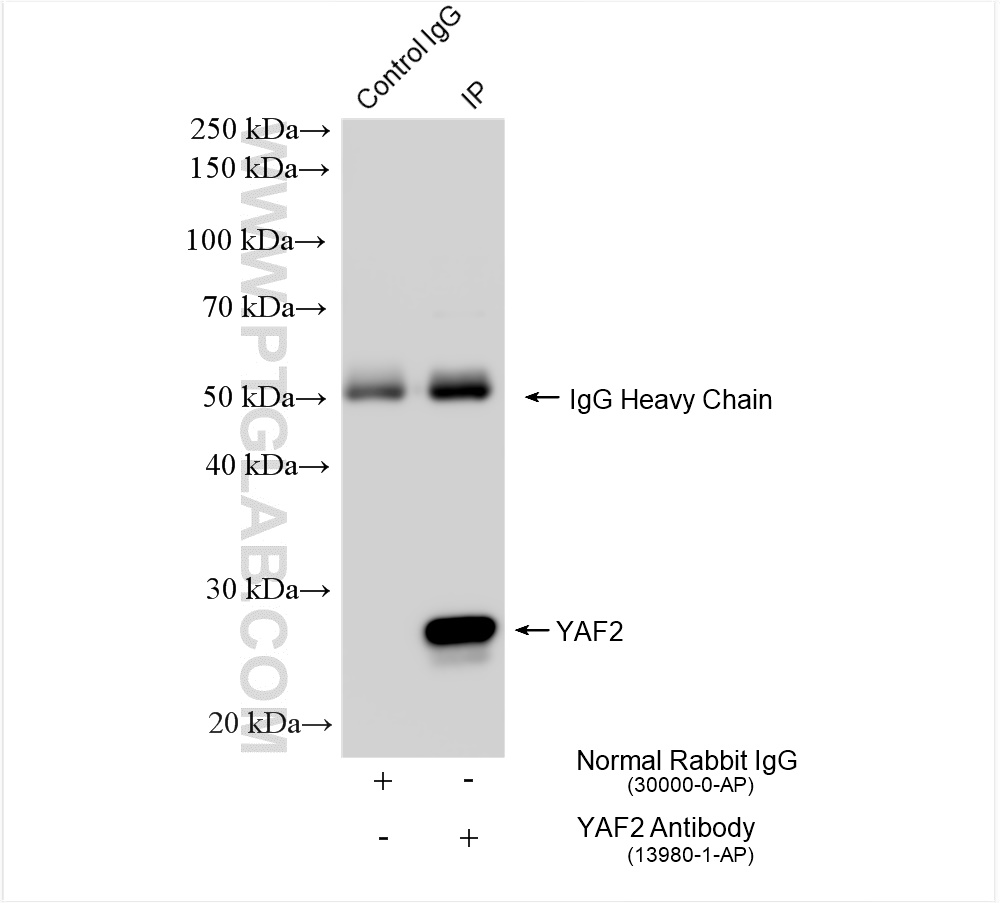 IP experiment of HeLa using 13980-1-AP